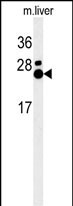 1 - MMD Antibody (N-term) AP5167a