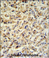 14 - PRELP Antibody (Center) AP6665C