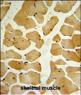 14 - SPHK1 Antibody (C-term R414) AP7237B