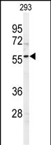 1 - SPHK1 Antibody (C-term R414) AP7237B