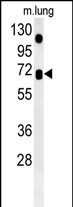 1 - ASB15 Antibody  (Center) AP5180c