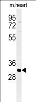 1 - ATP4B Antibody (N-term) AP5181a