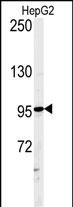 1 - ATXN2L Antibody (C-term) AP5183b
