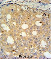14 - CMPK2 Antibody (Center) AP5206c