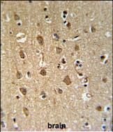 14 - ENPP6 Antibody (Center) AP5216c
