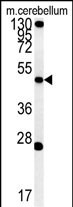 1 - ENPP6 Antibody (Center) AP5216c