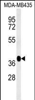 1 - FBXL14 Antibody (C-term) AP5220b