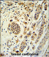 14 - FBXL15 Antibody (C-term) AP5221B