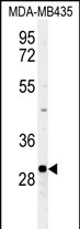 1 - FBXL15 Antibody (C-term) AP5221B
