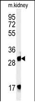 1 - FBXL15 Antibody (C-term) AP5221B