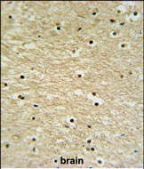 14 - K0415 Antibody (Center) AP5236c