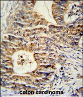 14 - KLHL24 Antibody (Center) AP5238c