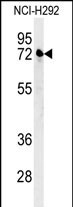 1 - KLHL24 Antibody (Center) AP5238c