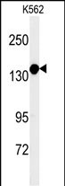 1 - MTMR15 Antibody  (N-term) AP5247a