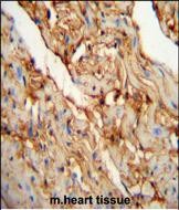 14 - MYOZ1 Antibody (Center) AP5248c