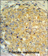 14 - RNASEK Antibody (Center) AP5259c