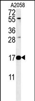 1 - RNASEK Antibody (Center) AP5259c