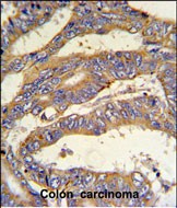 14 - RSAD1 Antibody (C-term) AP5262B