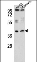 1 - RSAD1 Antibody (C-term) AP5262B