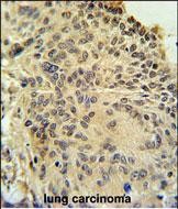 14 - RSPO2 Antibody (C-term) AP5264b