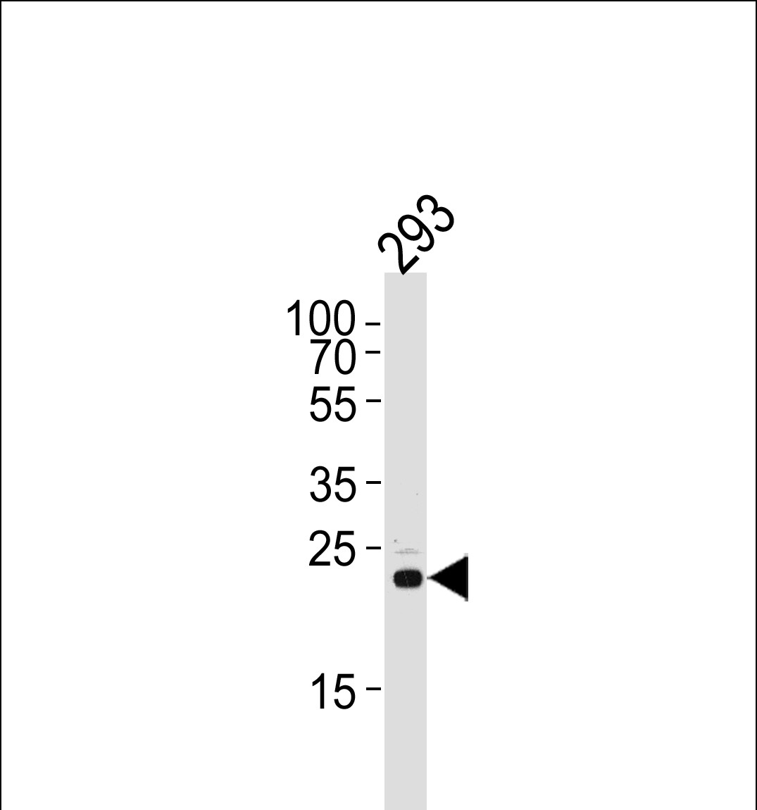 1 - RSPO2 Antibody (C-term) AP5264b