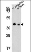 1 - SLC25A19 Antibody (C-term) AP5269b