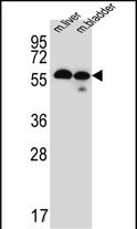 1 - TMEM87B Antibody (C-term) AP5285b