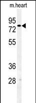 1 - TTLL11 Antibody (C-term) AP5291b