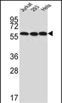 1 - UTP6 Antibody (N-term) AP5296a