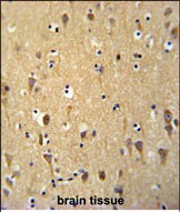 14 - WDR73 Antibody (N-term) AP5297a