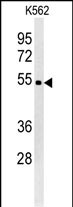 1 - WDR73 Antibody (N-term) AP5297a