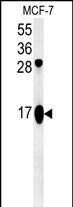 1 - ATP5J2 Antibody (Center) AP5346c