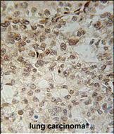 14 - C14orf179 Antibody (Center) AP5370c