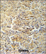 14 - WDR67 Antibody (C-term) AP5393b