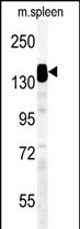 1 - WDR67 Antibody (C-term) AP5393b