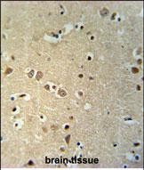 14 - KCTD21 Antibody (C-term) AP5408b