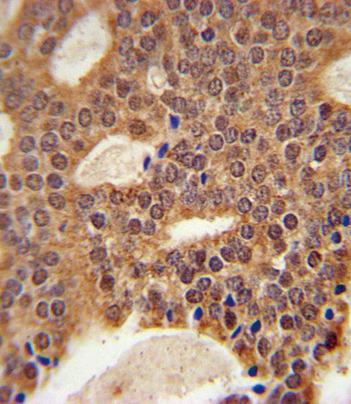 14 - DCLRE1B Antibody (Center) AP5426c