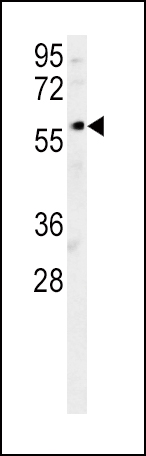 1 - DCLRE1B Antibody (Center) AP5426c