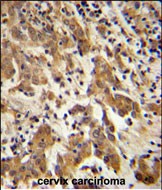 14 - GKAP1 Antibody (C-term) AP5474b