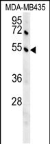 1 - GKAP1 Antibody (C-term) AP5474b