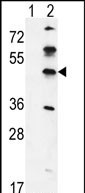 1 - GKAP1 Antibody (C-term) AP5474b