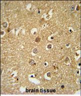 14 - RAB11FIP2 Antibody (Center) AP5475c