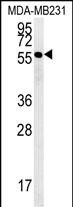 1 - RAB11FIP2 Antibody (Center) AP5475c