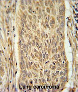 14 - INMT Antibody (Center) AP5476c