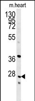 1 - INMT Antibody (Center) AP5476c