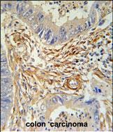 14 - PRB2 Antibody (C-term) AP5480b