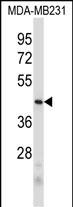 1 - PRB2 Antibody (C-term) AP5480b