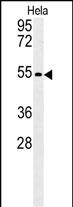 1 - KLF17 Antibody  (C-term) AP5507b