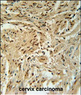 14 - BLOC1S2 Antibody (Center) AP5538c