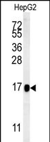1 - BLOC1S2 Antibody (Center) AP5538c